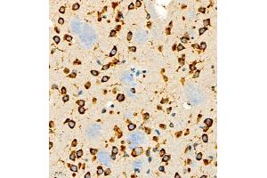 Immunohistochemistry of paraffin embedded rat brain using P4H (ABIN7074215) at dilution of 1:700 (400x lens) (HIF Prolyl Hydroxylase anticorps)