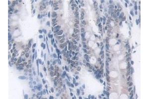 Detection of TKT in Rat Colon Tissue using Polyclonal Antibody to Transketolase (TKT)