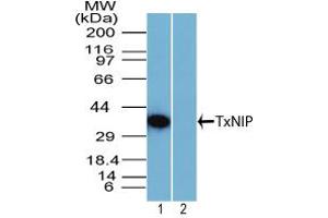 Image no. 1 for anti-Thioredoxin Interacting Protein (TXNIP) (AA 100-150) antibody (ABIN960393) (TXNIP anticorps  (AA 100-150))
