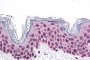 Human Skin: Formalin-Fixed, Paraffin-Embedded (FFPE) (CDC27 anticorps  (C-Term))