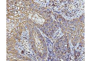 IHC analysis of CD147/Emmprin using anti-CD147/Emmprin antibody (ABIN7599997).