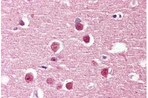 Brain, cortex, Human: Formalin-Fixed, Paraffin-Embedded (FFPE) (ADGRV1 / GPR98 anticorps  (Internal Region))
