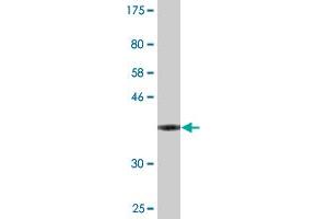 Western Blot detection against Immunogen (36. (VASH1 anticorps  (AA 3-100))
