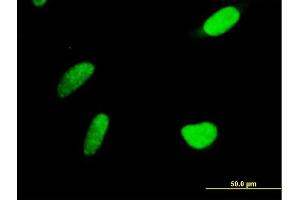 Immunofluorescence of purified MaxPab antibody to PAPSS2 on HeLa cell.