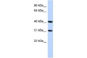 Western Blotting (WB) image for anti-Family with Sequence Similarity 46, Member D (FAM46D) antibody (ABIN2459624) (FAM46D anticorps)