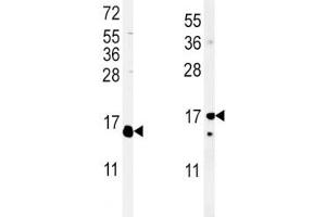 (Left) Western blot analysis of IL-4 antibody and WiDr lysate