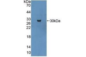 Detection of Recombinant MAP1A, Mouse using Polyclonal Antibody to Microtubule Associated Protein 1A (MAP1A) (MAP1A anticorps  (AA 2552-2759))