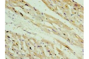 Immunohistochemistry of paraffin-embedded human heart tissue using ABIN7170926 at dilution of 1:100 (OXCT1 anticorps  (AA 261-520))