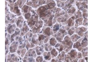 DAB staining on IHC-P; Samples: Mouse Stomach Tissue (MRPL1 anticorps  (AA 143-336))