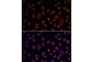 Immunofluorescence analysis of L929 cells using ULK1 antibody (ABIN6134005, ABIN6149921, ABIN6149922 and ABIN6224624) at dilution of 1:100.