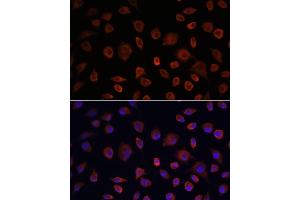 Immunofluorescence analysis of L929 cells using ULK1 antibody (ABIN6134005, ABIN6149921, ABIN6149922 and ABIN6224624) at dilution of 1:100. (ULK1 anticorps  (AA 400-499))