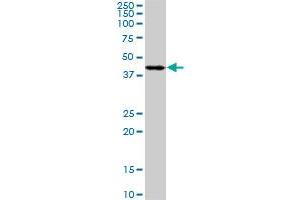 PDK2 monoclonal antibody (M02), clone 5F8. (PDK2 anticorps  (AA 187-276))