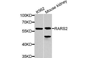 Western blot analysis of extracts of various cell lines, using RARS2 antibody. (RARS2 anticorps)