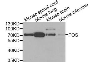Western blot analysis of extracts of various cell lines, using FOS antibody. (c-FOS anticorps)