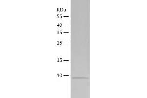 Western Blotting (WB) image for Jumping Translocation Breakpoint (JTB) (AA 31-105) protein (His-IF2DI Tag) (ABIN7123649)