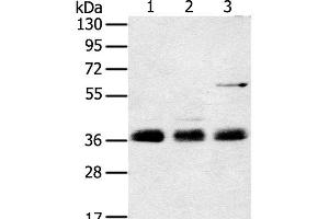 Western Blot analysis of Mouse lung tissue, NIH/3T3 and hepg2 cell using ANKRD1 Polyclonal Antibody at dilution of 1:400 (ANKRD1 anticorps)