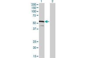 Western Blot analysis of IRF4 expression in transfected 293T cell line by IRF4 monoclonal antibody (M02), clone 2F2. (IRF4 anticorps  (AA 342-451))