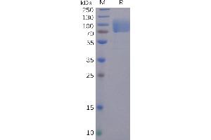 SARS-CoV-2 (2019-nCoV) S1 protein NTD, hFc Tag on SDS-PAGE under reducing condition.