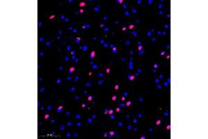 Immunofluorescence of paraffin embedded mouse brain using kb12 (ABIN7075406) at dilution of 1:700 (300x lens) (p130 anticorps)