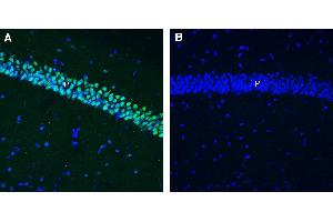 Expression of NPTX2 in mouse hippocampus. (NPTX2 anticorps  (Secreted))
