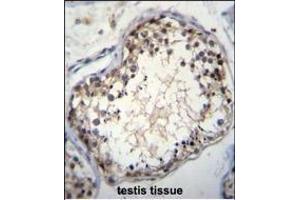 OVOS Antibody (N-term) (ABIN655570 and ABIN2845070)a immunohistochemistry analysis in formalin fixed and paraffin embedded human testis tissue followed by peroxidase conjugation of the secondary antibody and DAB staining.