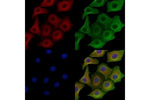 ABIN6258547 and ABIN6275031 staining Hela cells by IF/ICC. (C1QL2 anticorps  (C-Term))