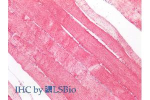 ABIN768566 (5µg/ml) staining of paraffin embedded Human Skeletal Muscle.
