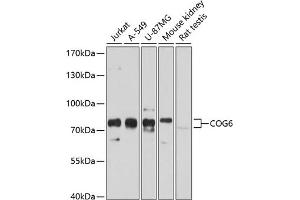 Western blot analysis of extracts of various cell lines, using COG6 antibody  at 1:1000 dilution. (COG6 anticorps  (AA 508-657))