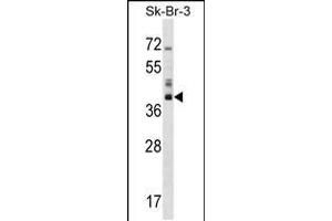 Western blot analysis in SK-BR-3 cell line lysates (35ug/lane). (HSD17B1 anticorps  (C-Term))