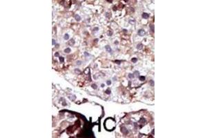 Immunohistochemistry (IHC) image for anti-Sphingosine Kinase 2 (SPHK2) antibody (ABIN3003068)