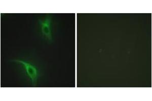 Immunofluorescence analysis of HeLa cells, using CKS1 Antibody. (CKS1 anticorps  (AA 10-59))