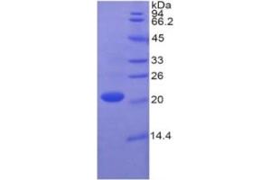 SDS-PAGE of Protein Standard from the Kit (Highly purified E. (Caspase 1 Kit ELISA)