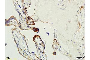 Formalin-fixed and paraffin embedded human placenta tissue labeled with Anti-Factor XIII Polyclonal Antibody, Unconjugated (ABIN731738) at 1:200 followed by conjugation to the secondary antibody, (SP-0023), and DAB staining