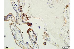 Formalin-fixed and paraffin embedded human placenta tissue labeled with Anti-Factor XIII Polyclonal Antibody, Unconjugated (ABIN731738) at 1:200 followed by conjugation to the secondary antibody, (SP-0023), and DAB staining (Factor XIII anticorps  (AA 331-732))