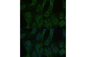 Immunofluorescence analysis of C6 cells using F antibody (ABIN6129530, ABIN6140428, ABIN6140430 and ABIN6215290) at dilution of 1:100.
