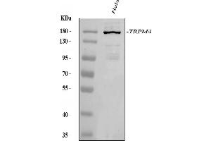 Western blot analysis of TRPM4 using anti-TRPM4 antibody (ABIN3044557).