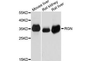 Western blot analysis of extracts of various cell lines, using RGN antibody.