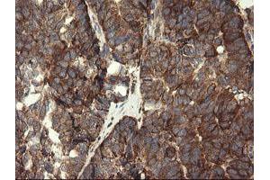 Image no. 3 for anti-Pogo Transposable Element with KRAB Domain (POGK) antibody (ABIN1500328)