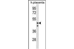 Western blot analysis in human placenta tissue lysates (35ug/lane). (CLUL1 anticorps  (C-Term))