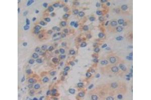 Used in DAB staining on fromalin fixed paraffin- embedded Kidney tissue (CCDC60 anticorps  (AA 388-520))