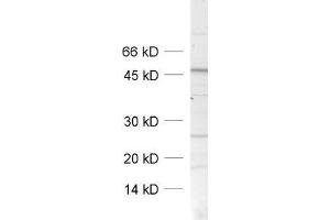 dilution: 1 : 1000, sample: crude synaptosomal fraction of rat brain (P2) (SNAP47 anticorps)