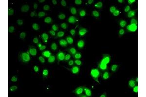 Immunofluorescence analysis of HeLa cells using GABARAP antibody (ABIN6134237, ABIN6140873, ABIN6140876 and ABIN6217999). (GABARAP anticorps  (AA 1-100))