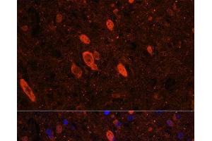 Immunofluorescence analysis of Rat brain using ELAVL3 Polyclonal Antibody at dilution of 1:100 (40x lens).