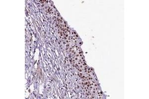Immunohistochemical staining of human urinary bladder with SAMD10 polyclonal antibody  shows strong nuclear positivity in urothelial cells. (SAMD10 anticorps)