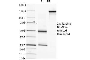SDS-PAGE Analysis of Purified anti-Biotin Mouse Monoclonal antibody (Hyb-8). (Biotin anticorps)