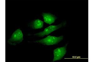 Immunofluorescence of purified MaxPab antibody to METTL2 on HeLa cell. (METTL2B anticorps  (AA 1-313))