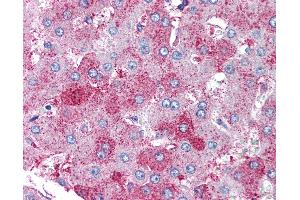 Anti-SUPT16H antibody IHC of human liver. (SUPT16H anticorps)