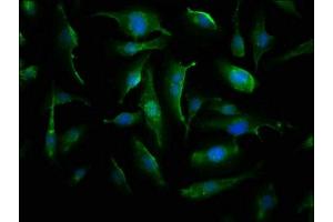 Immunofluorescence staining of U251 cells with ABIN7143857 at 1:66, counter-stained with DAPI.