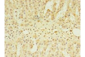 Immunohistochemistry of paraffin-embedded human adrenal gland tissue using ABIN7147640 at dilution of 1:100