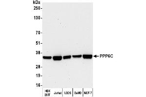 Western Blotting (WB) image for anti-Protein Phosphatase 6, Catalytic Subunit (PPP6C) (C-Term) antibody (ABIN7451563)